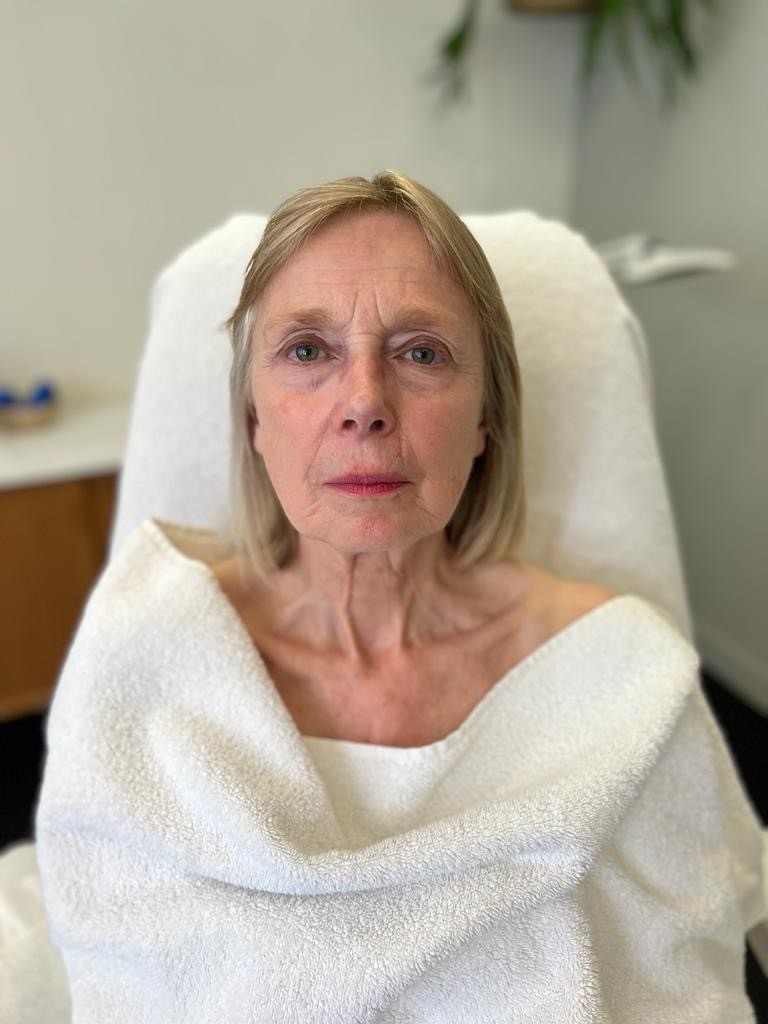 Carla voor de Bio-Lift Start Kuur