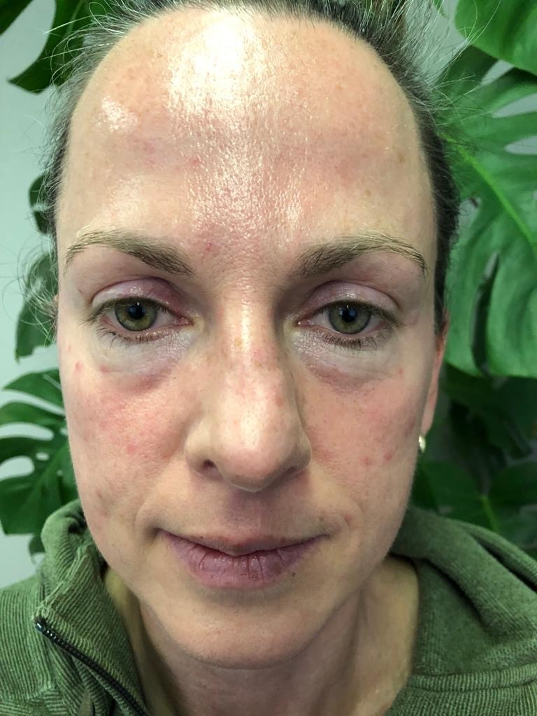 Margret bij de start van de Bio-Lift Start Kuur